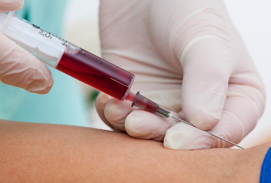 واکسیناسیون در بیماری تحت همودیالیز