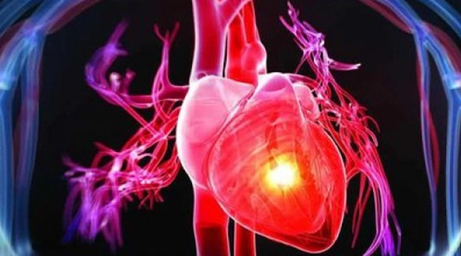 انژیوگرافی قلب