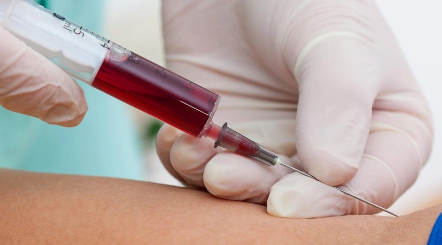 واکسیناسیون در بیماری تحت همودیالیز